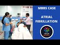 MBBS Case Discussion || Atrial Fibrillation || Heart Failure