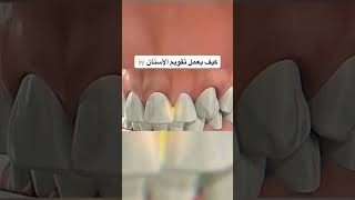 كيف يعمل تقويم الاسنان 🦷😳