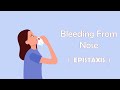 Bleeding From Nose (Epistaxis)