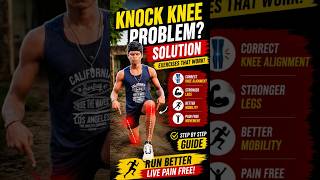 🦵 Knock Knee Problem? ଏହି 5ଟି Exercises ନିୟମିତ କରନ୍ତୁ ଏବଂ Leg Strength &amp; Mobility ବଢ଼ାନ୍ତୁ! 💪🏃‍♂️