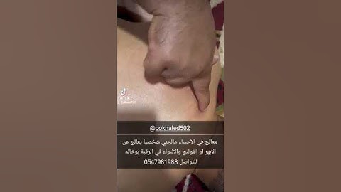 معالج القولنج والابر هر.  التواء الرغبة في الاحساء