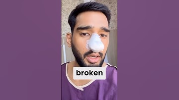 Impact of Nose Surgery - Anshul Jubli #ufcindia