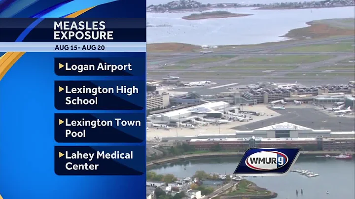 Mass. health officials warn of possible measles exposure at several Boston area locations