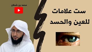 علامات العين والحسد