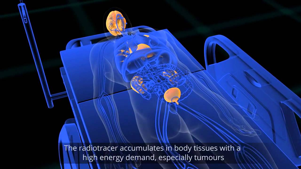 ANSTO PET Scanner animation HD - YouTube