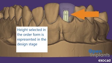 How to Use the Open Implants Library in Exocad