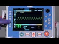 X Series® Advanced: Cardioversion (English)