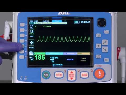 Cardioversion