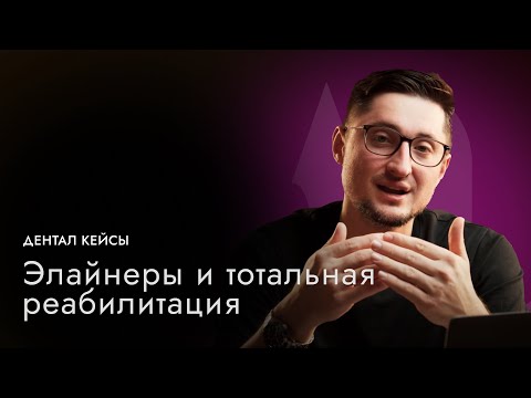 Тотальная реабилитация | Виниры, Коронки, Элайнеры | Артур Лукьяненко