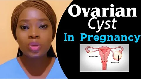 Ovarian cyst during pregnancy // causes, treatments and prevention #nurse_emetuobi