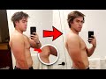 He REVERSED His Gyno In 31 Days WITHOUT Surgery!? - Before And After