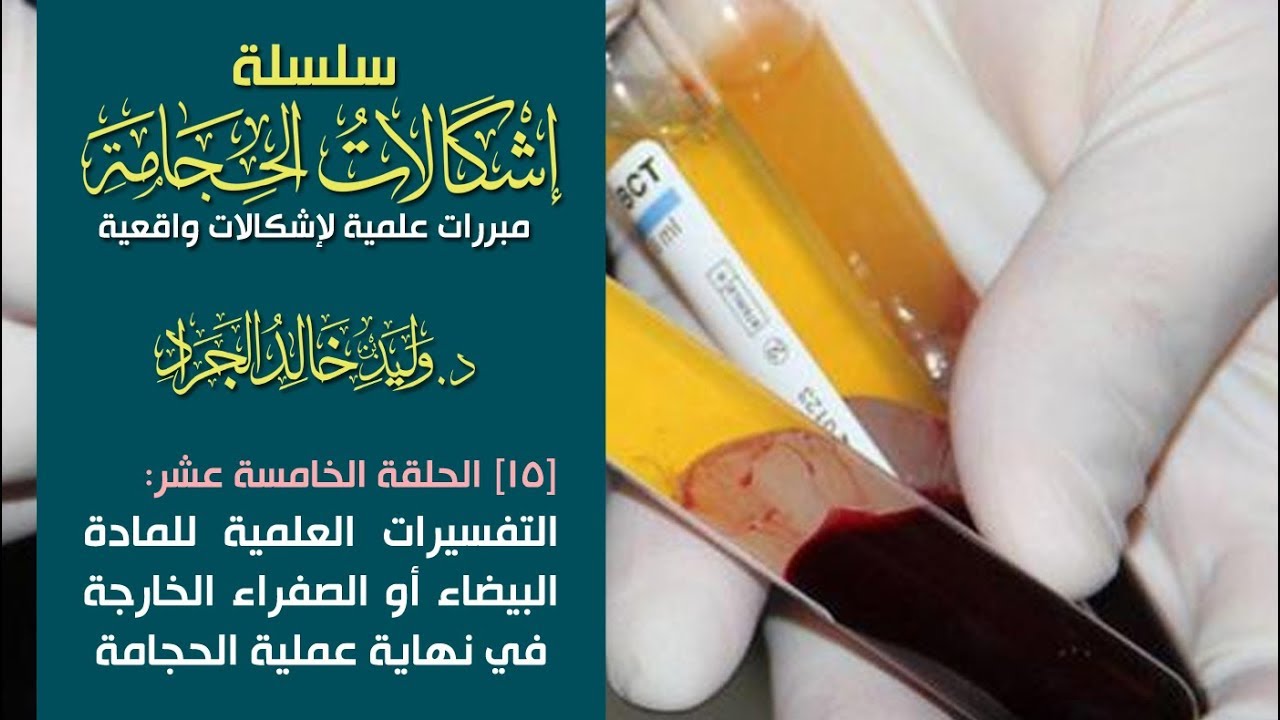 #سلسلة_إشكالات_الحجامة [15] التفسيرات العلمية للمادة البيضاء أو الصفراء الخارجةفي نهايةعمليةالحجامة