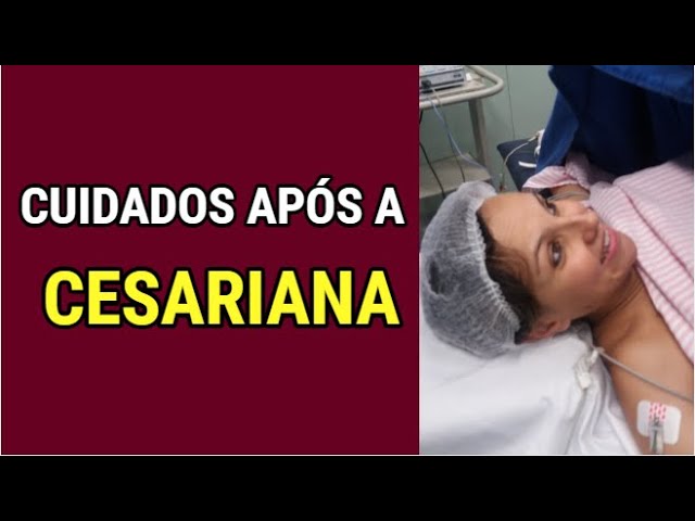 RECUPERAÇÃO PÓS CESÁREA, CORPO PÓS CIRURGIA, PUERPÉRIO, ANESTESIA