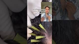 PDO threads for hair growth #pdothreads