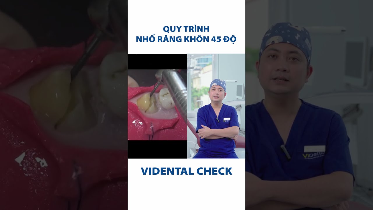 Quy trình nhổ răng khôn mọc lệch| Nha Khoa ViDental #nhasi #nhorangkhon #shorts #rangmieng #rangkhon