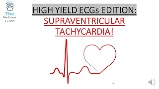 HIGH YIELD ECGs EDITION: SUPRAVENTRICULAR TACHYCARDIA (SVT)