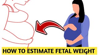 HOW to ESTIMATE FETAL WEIGHT in pregnancy