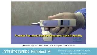 นำเสนอ Periotest M