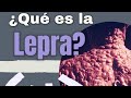 ¿Qué es la Lepra? 7 datos que debes saber