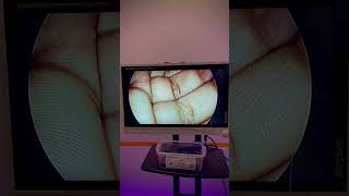 Stryker 1288 HD Camera System with 26&quot; Vision PRO LED Medical Grade Monitor
