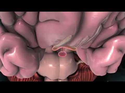 პოლიკისტოზური საკვერცხეები და უშვილობა