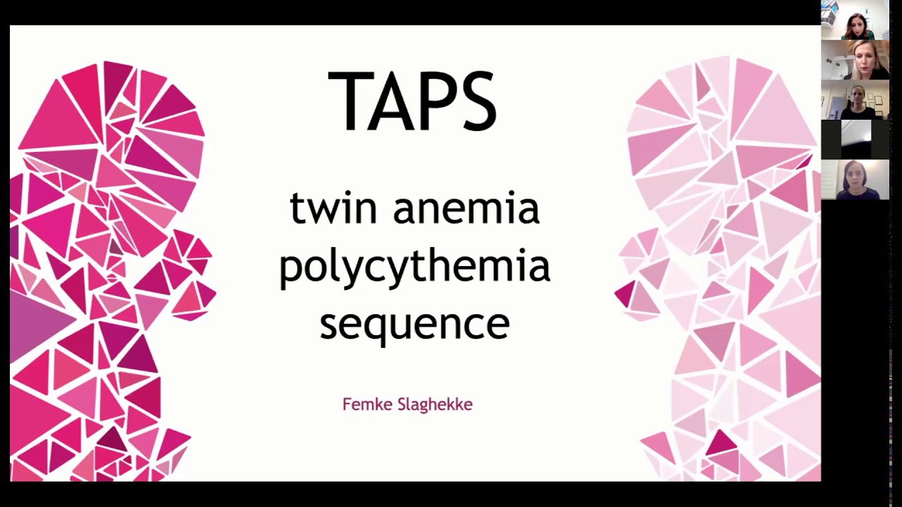 14th November 2020 inar Twin Anemia Polycythaemia Sequence (TAPS