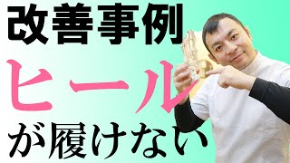 【外反母趾改善事例集】ヒールが履けない外反母趾の痛みが消えた！　京都外反母趾改善センター