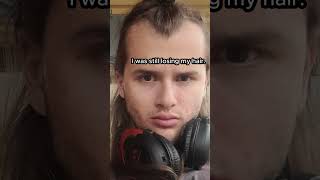 Famous RADICAL GLOW-UP TRANSFORMATION POST-PUBERTY    #shorts Net Worth