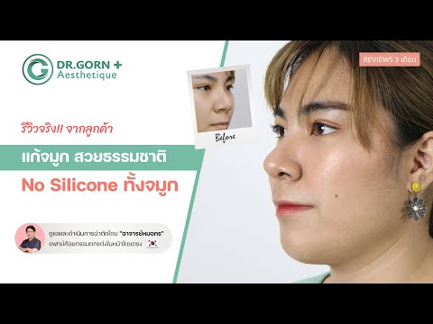 รีวิวจริง!! แก้จมูกไร้ซิลิโคนทั้งจมูก No silicone 100% l Dr.Gorn Aesthetique