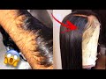 DIY: How To Bleach Knots Perfectly Natural Look |Beginner Friendly | Step By Step