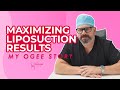 Maximizing Liposuction Results - My Ogee Story