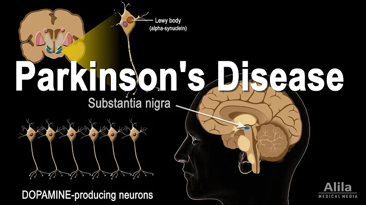 Parkinson's Disease, Animation