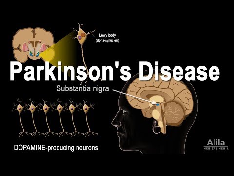 Parkinson&rsquo;s Disease, Animation