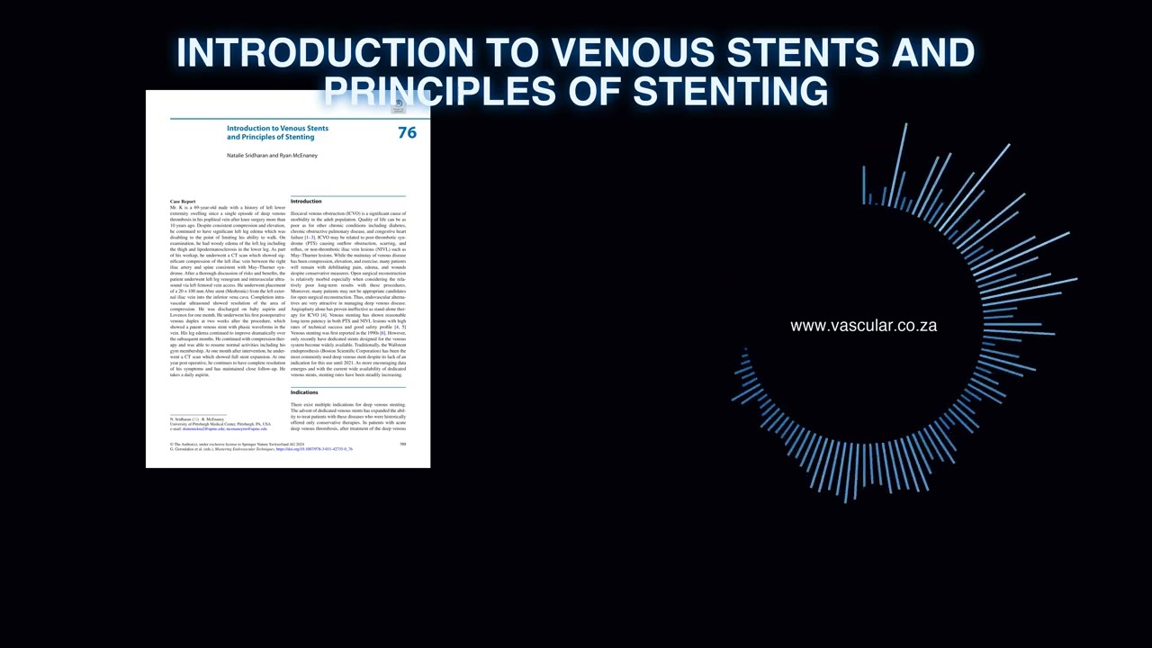 MET - 76 - Introduction to Venous Stents and Principles of Stenting - Deep Dive Podcast