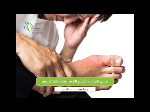 فيديو: لماذا يؤلم اصبع قدمك؟