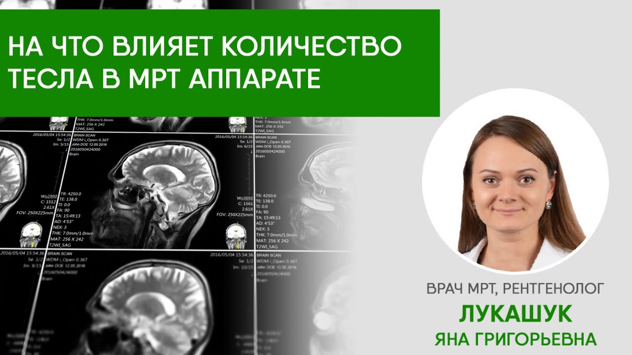 МРТ 1,5 и 3 Тесла - на что влияет мощность МРТ аппарата - YouTube