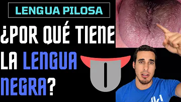 ¿Qué causa una lengua negra al morir?