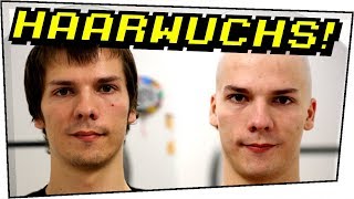 Haarwuchszeitraffer (30 Bilder/Sekunde) nach 180 Tagen! - Selbstexperimente #08