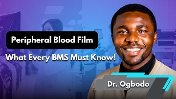 Peripheral Blood Film – Cell Identification & Associated Conditions | BMS Interview Tips