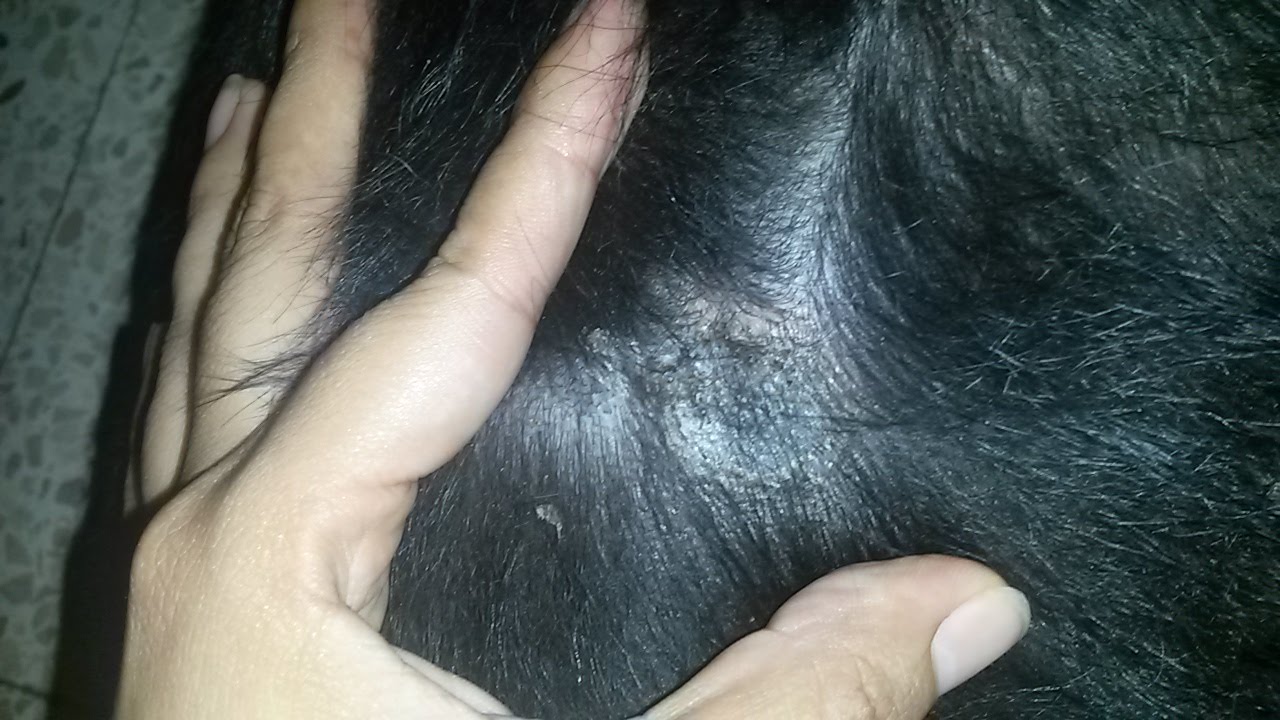 Teñirse El Pelo Mata Los Piojos