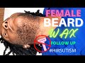 Female With A Beard Gets Waxed #Hirsutism #PCOS