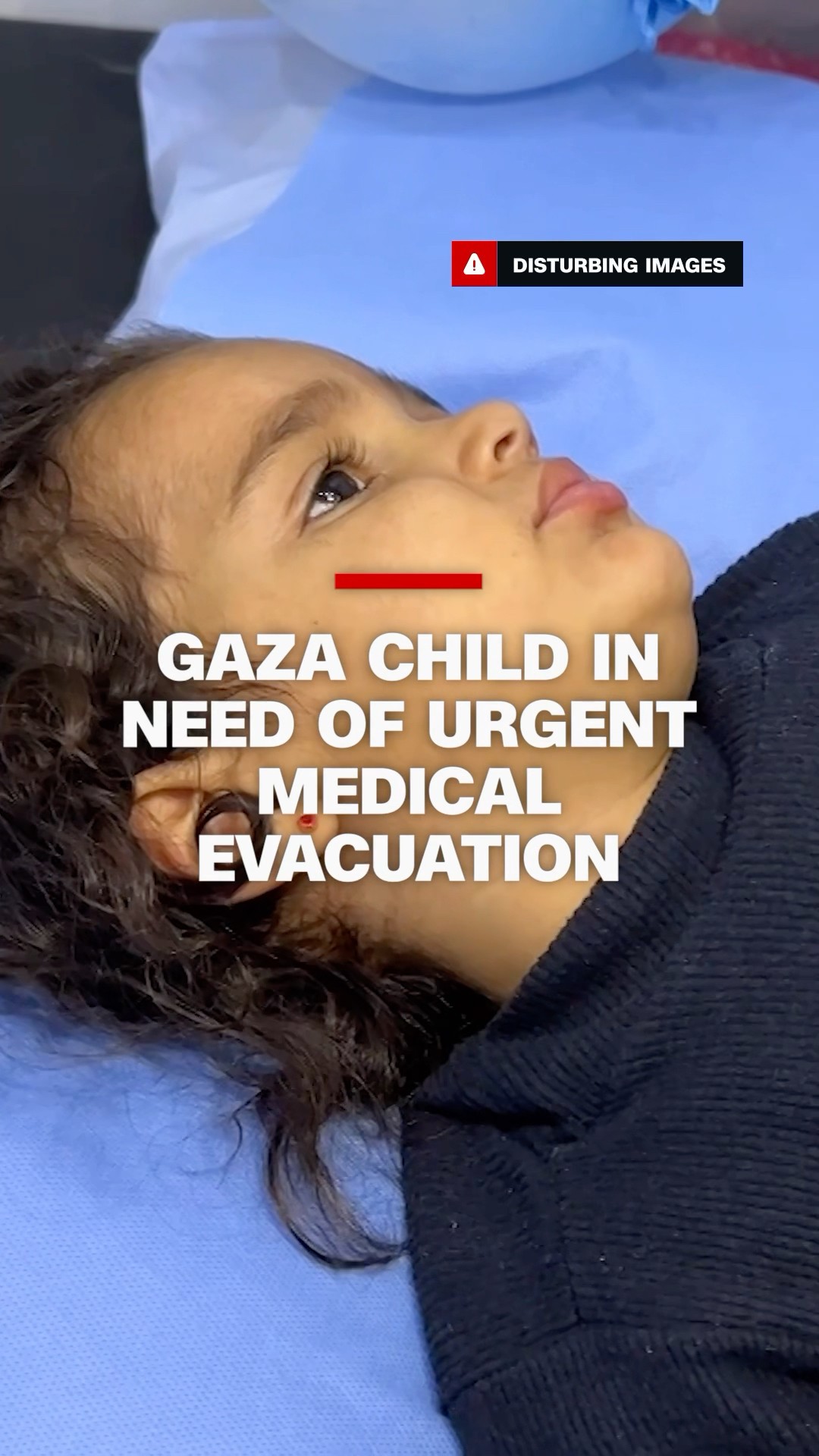 Disease puts 2-year-old girl in a race against time in Gaza