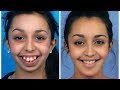 10 Incredible Before &amp; After Transformations Of People