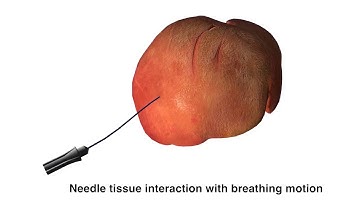 Real-time Error Control for Surgical Simulation