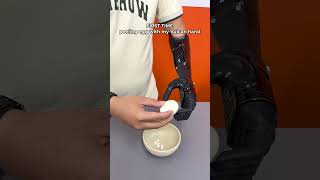 Peeling egg with his new hand #vulcan #prosthetics #bionic #orthotics #limbloss #disability