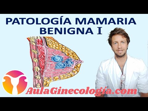 Video: Distonía vegetativo-vascular, ¿qué es, un síntoma o una enfermedad?