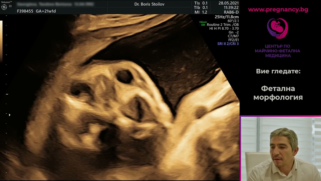 Фетална морфология при д-р Борис Стоилов