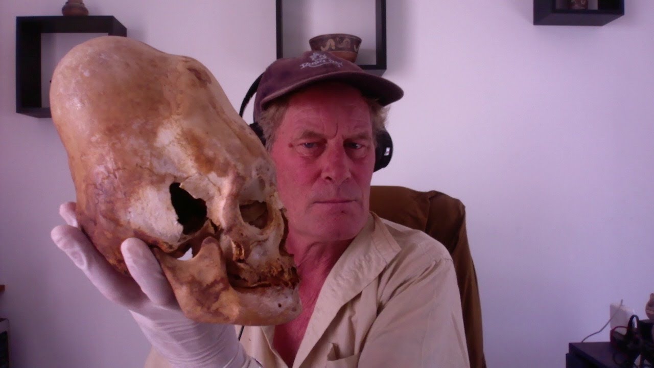 Examination Of An Elongated Paracas Skull In Peru - YouTube