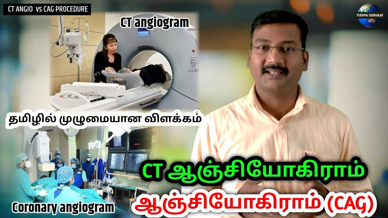 coronary-angiogram-vs-ct-angiogram-in-tamil-angiography-angioplasty