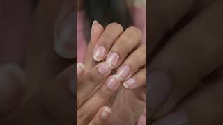 series Day-4 part 2 Nails solution 💅👌😱‼️#nails #nailsnailsnails #nailtutorial #shorts #viralshort